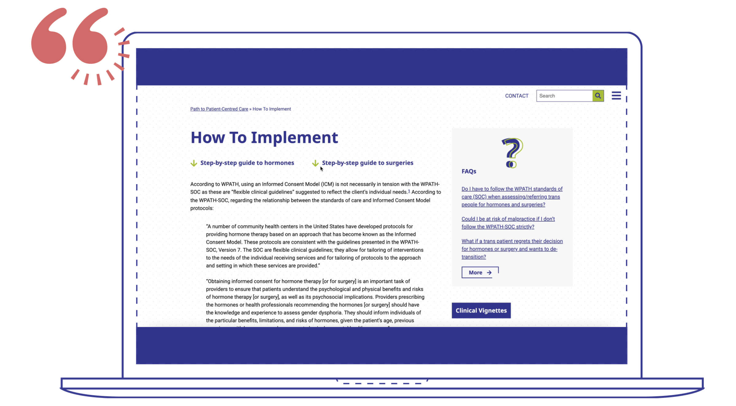 Illustration of a laptop screen displaying a webpage. The page is titled "How to Implement," featuring sections like "Step-by-step guide to hormones" and "Step-by-step guide to surgeries." There's also an FAQ section and a "Clinical Vignettes" button.